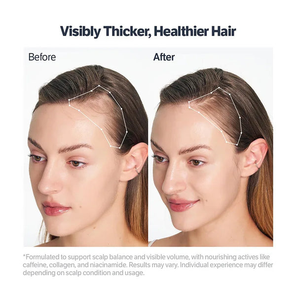 Scalp Hair Growth serum